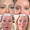 image:imageCurrentBody Skin Green Tea Serum  Hyaluronic Acid Vitamin C amp Peptides