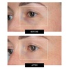 image:imageCurrentBody Skin LED Eye Perfector  Red Light Therapy for Eyes