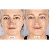 image:imageCurrentBody Skin Red Light Therapy Mask Series 1  LED Skincare Device
