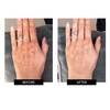 image:imageCurrentBody LED Hand Mask  Red Light Therapy for Hands